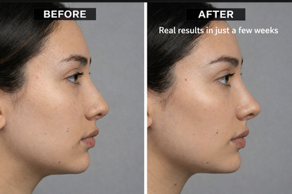 WandRave - Face Wrinkle Reducing Massager
