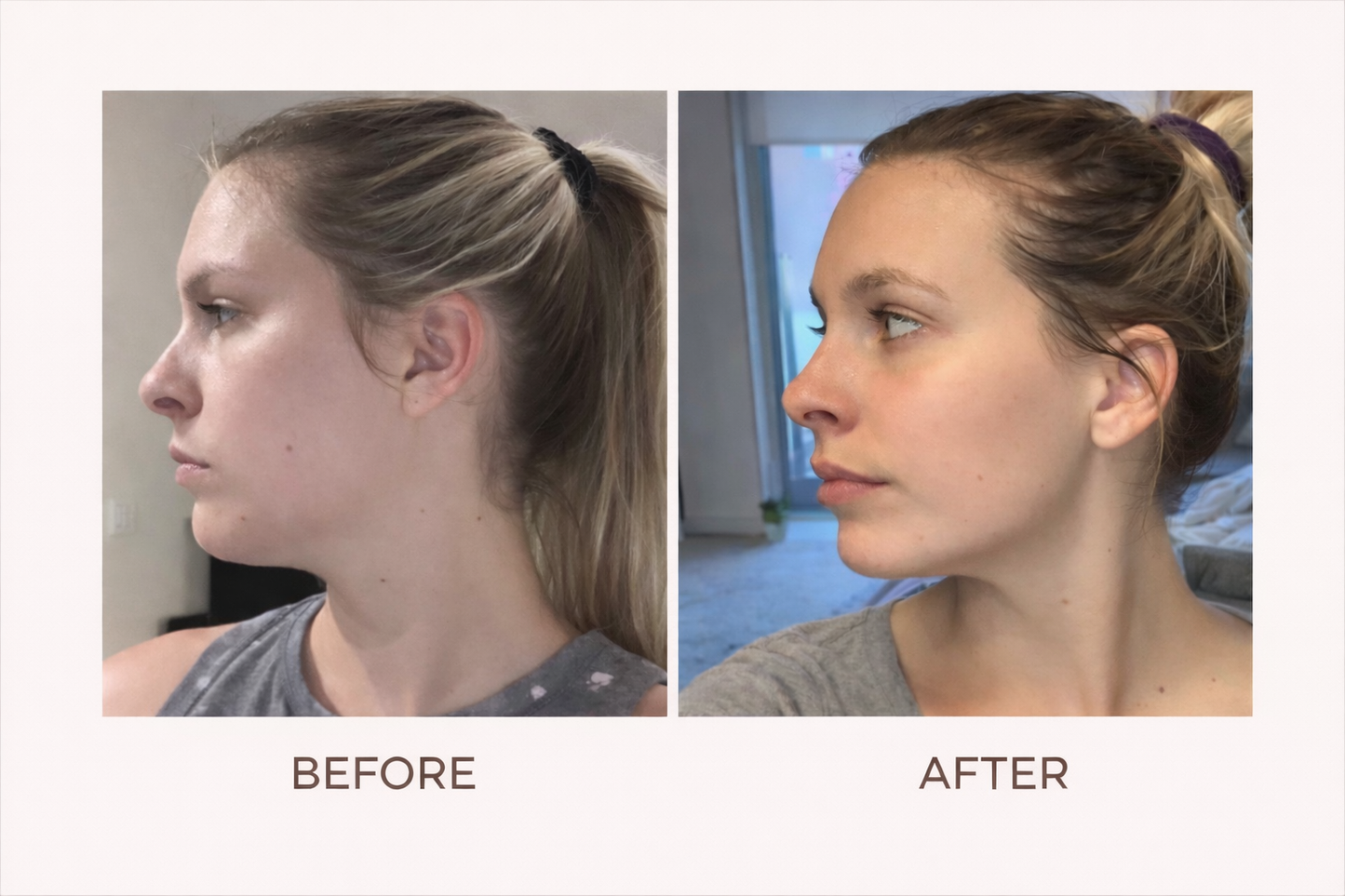 WandRave - Face Wrinkle Reducing Massager