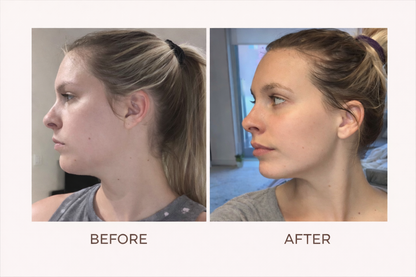 WandRave - Face Wrinkle Reducing Massager